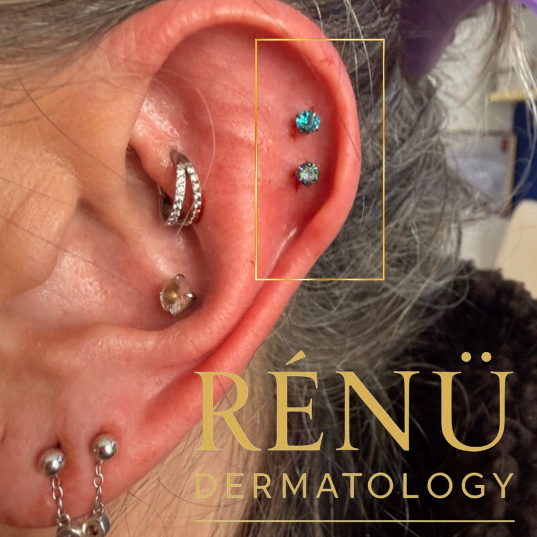 The Ultimate Guide to Professional Body Piercing in Lymington