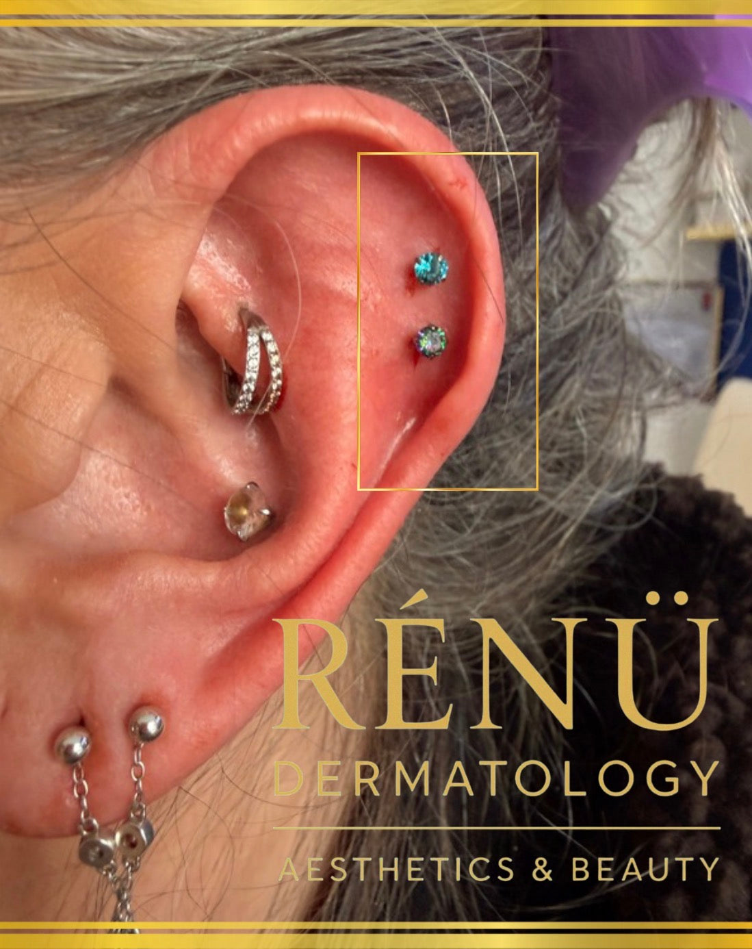 The Ultimate Guide to Professional Body Piercing in Lymington