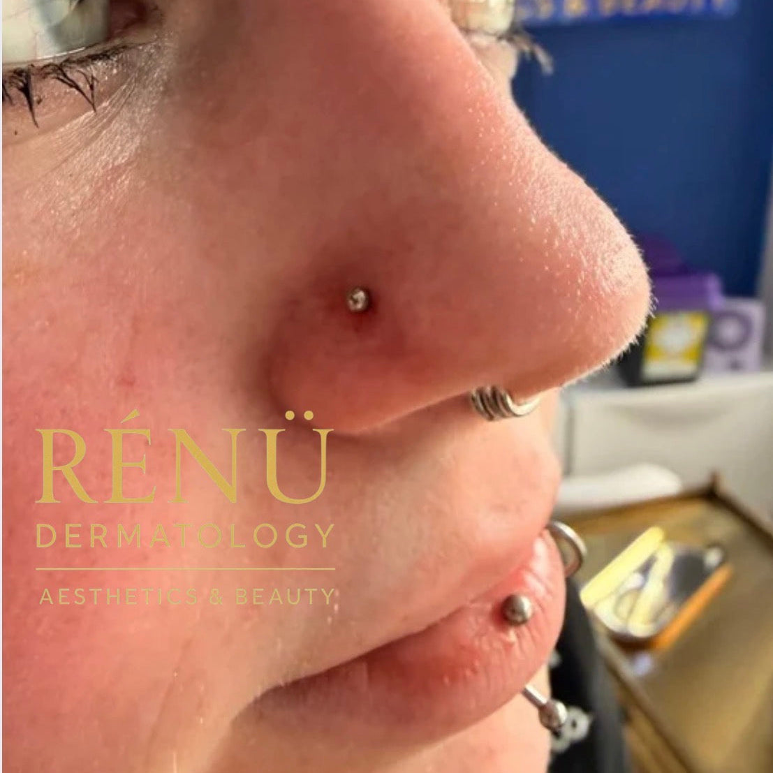 Affordable Above-the-Waist Body Piercing: Safe, Stylish and Budget-Friendly