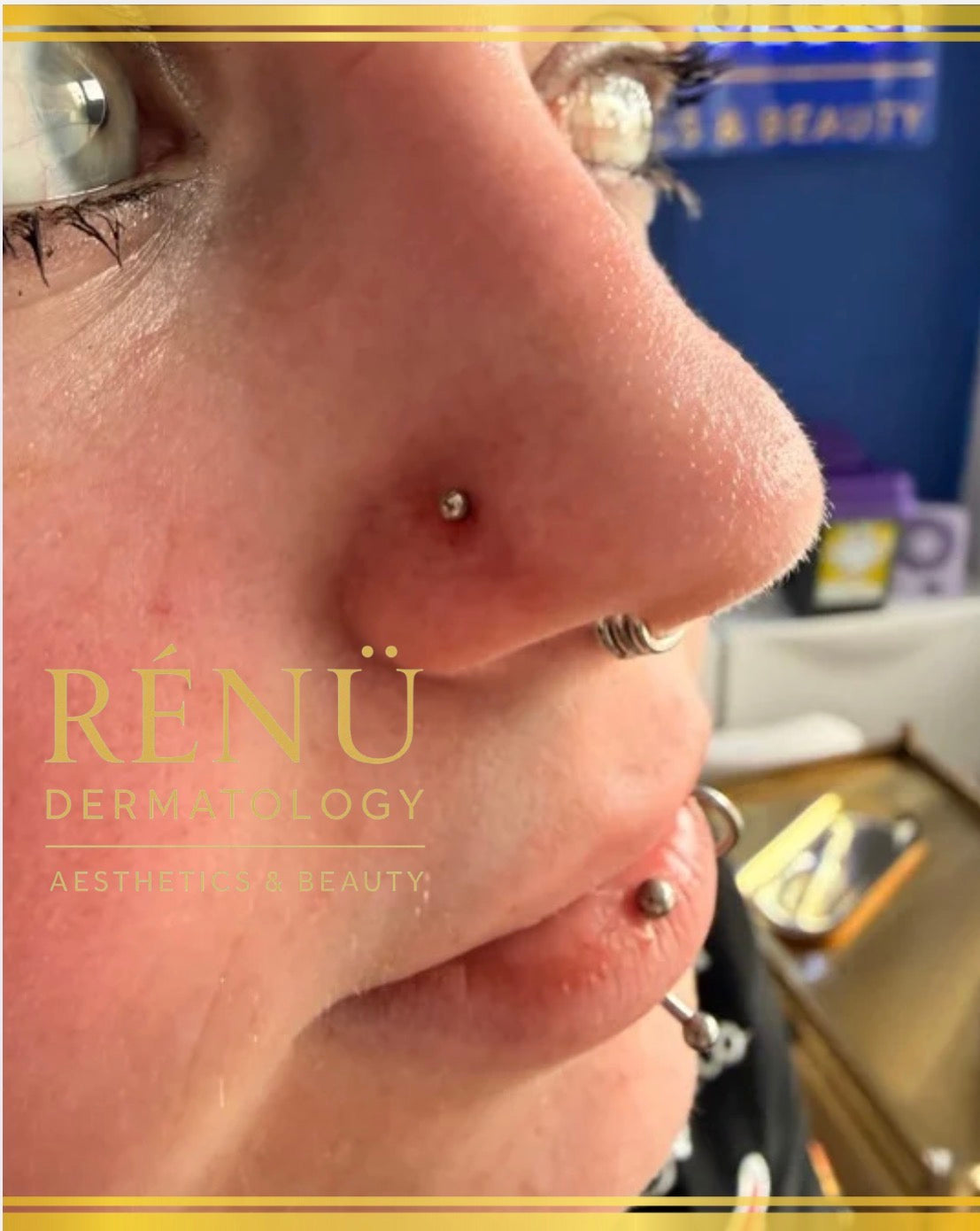 Affordable Above-the-Waist Body Piercing: Safe, Stylish and Budget-Friendly