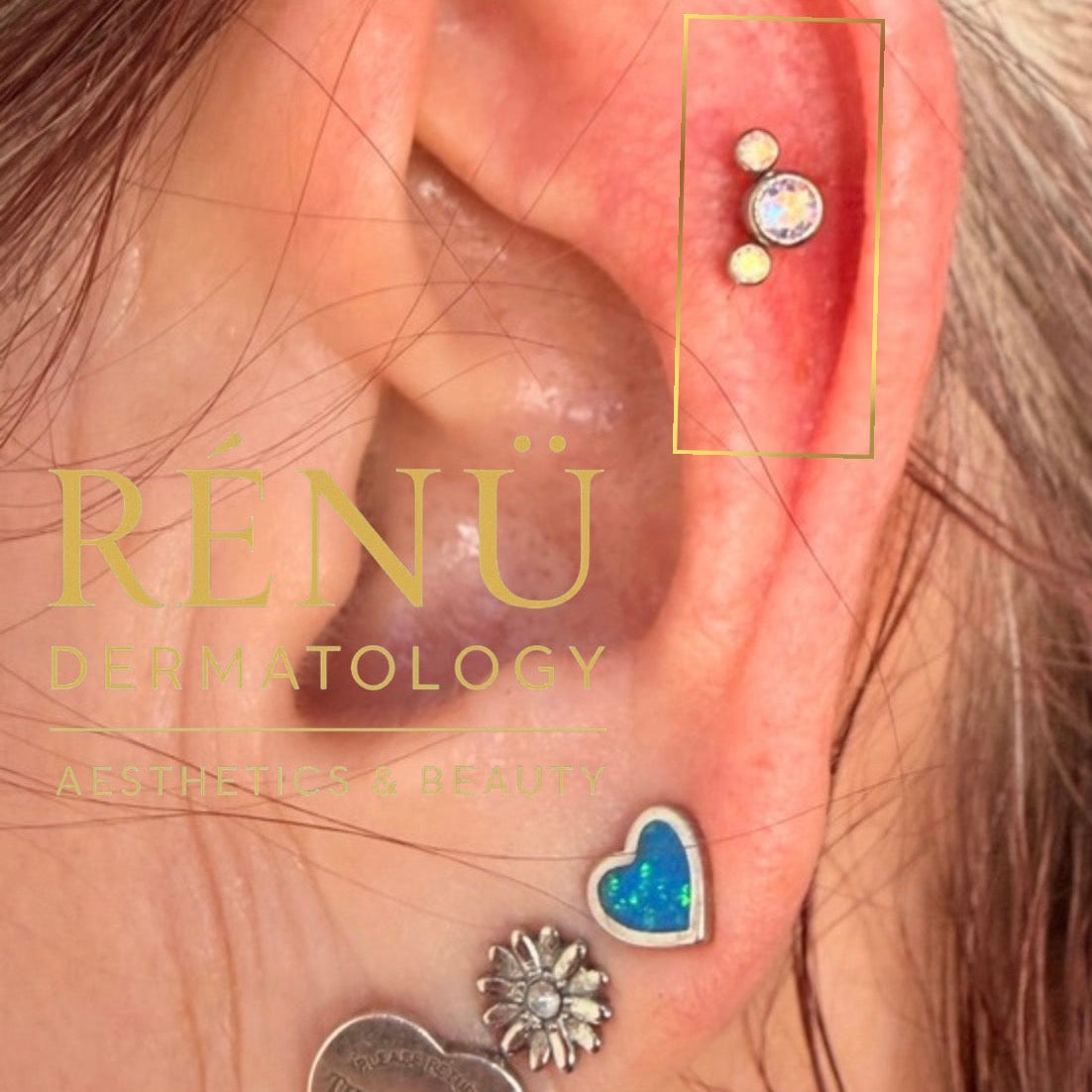 Why Downsizing Your Piercing Jewellery Is ESSENTIAL (Not Optional)