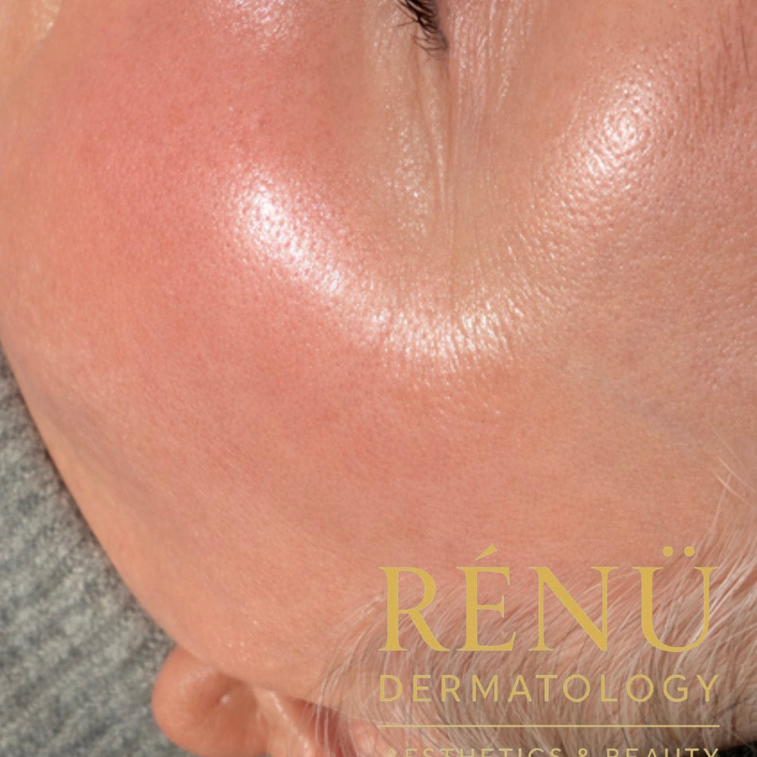 Common Skin Problems We Can Treat In Clinic | Rènü Dermatology Lymington