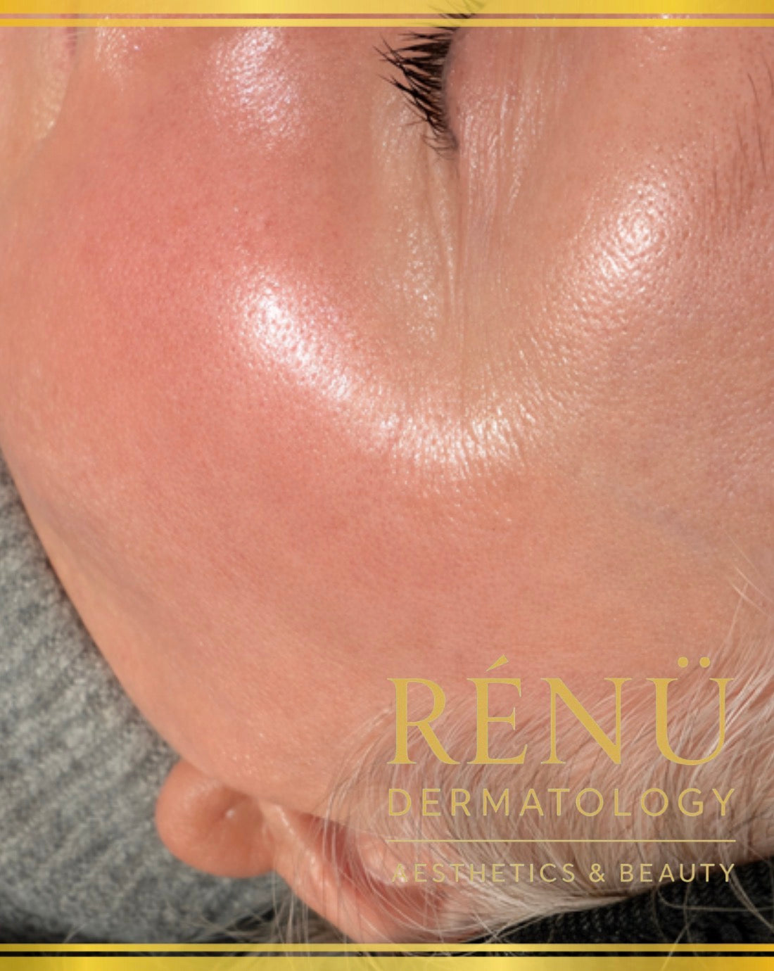 Common Skin Problems We Can Treat In Clinic | Rènü Dermatology Lymington