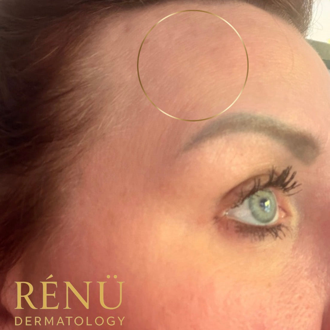 The Ultimate Guide to Aesthetic Treatments in Lymington: Everything You Need to Know