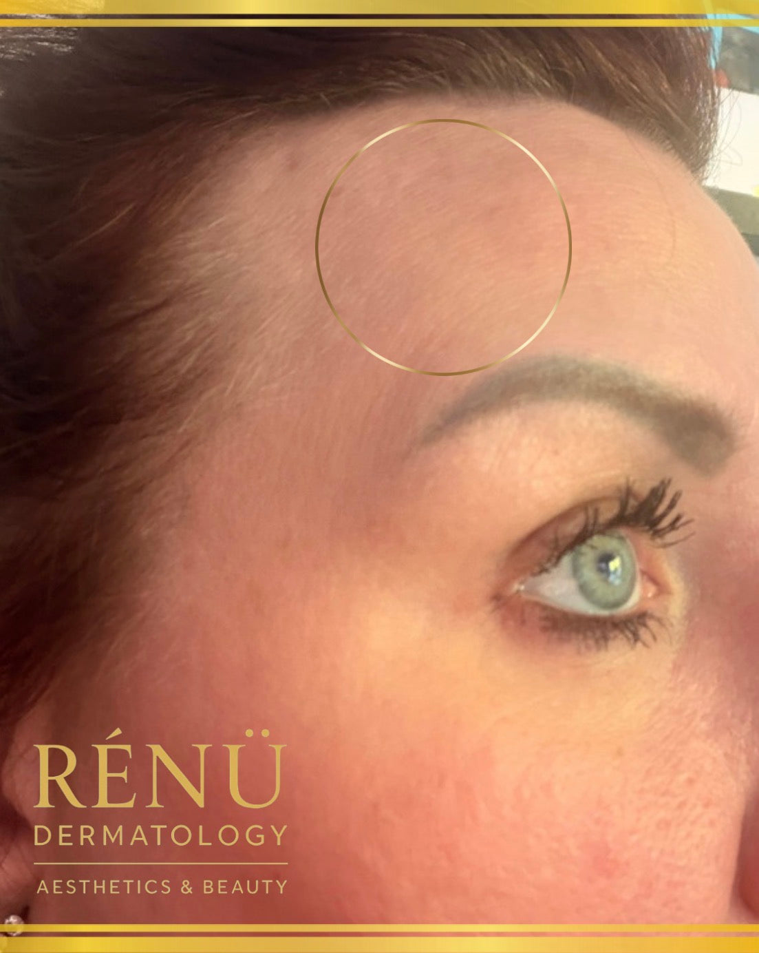 The Ultimate Guide to Aesthetic Treatments in Lymington: Everything You Need to Know