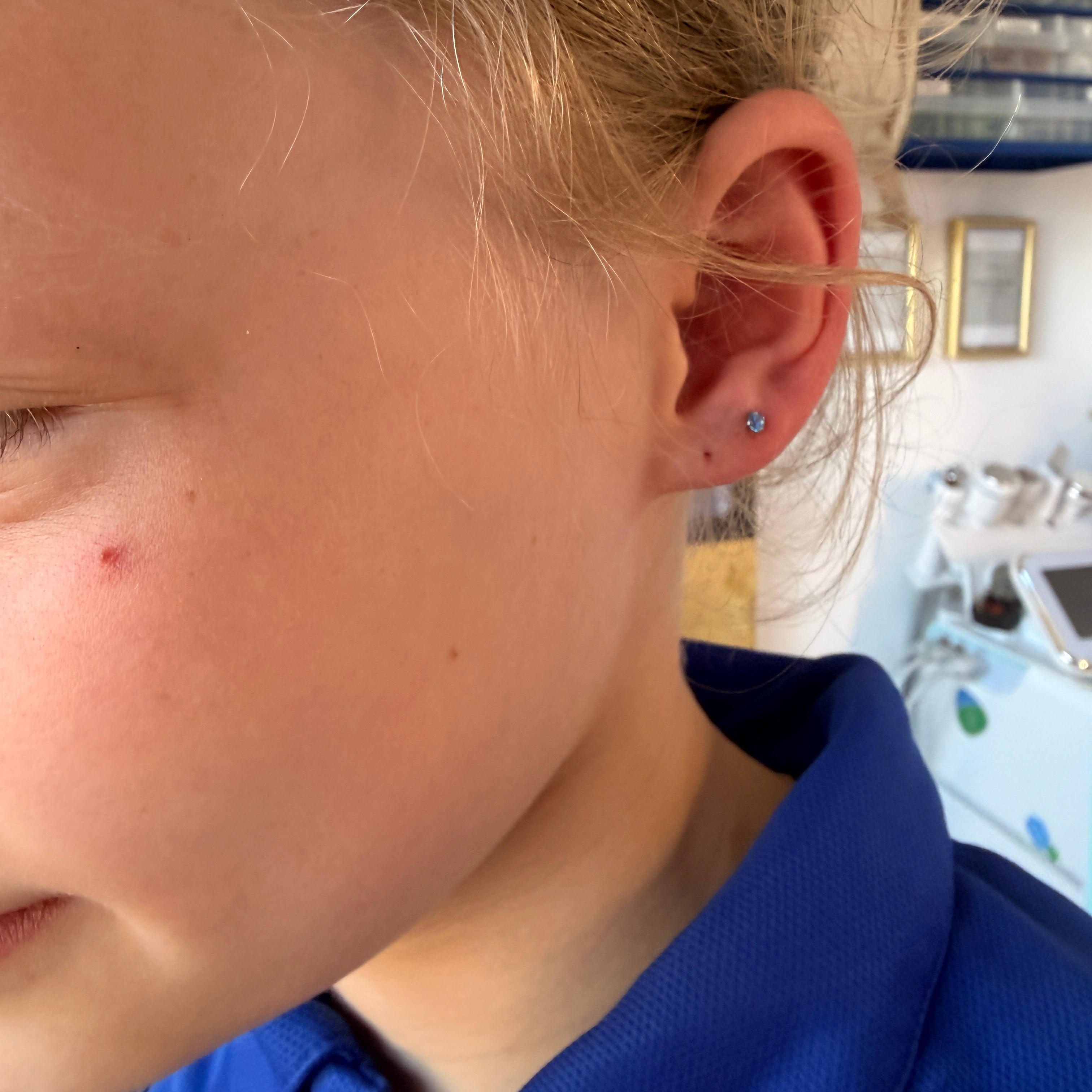 Children’s Ear Piercing in Lymington &amp; The New Forest