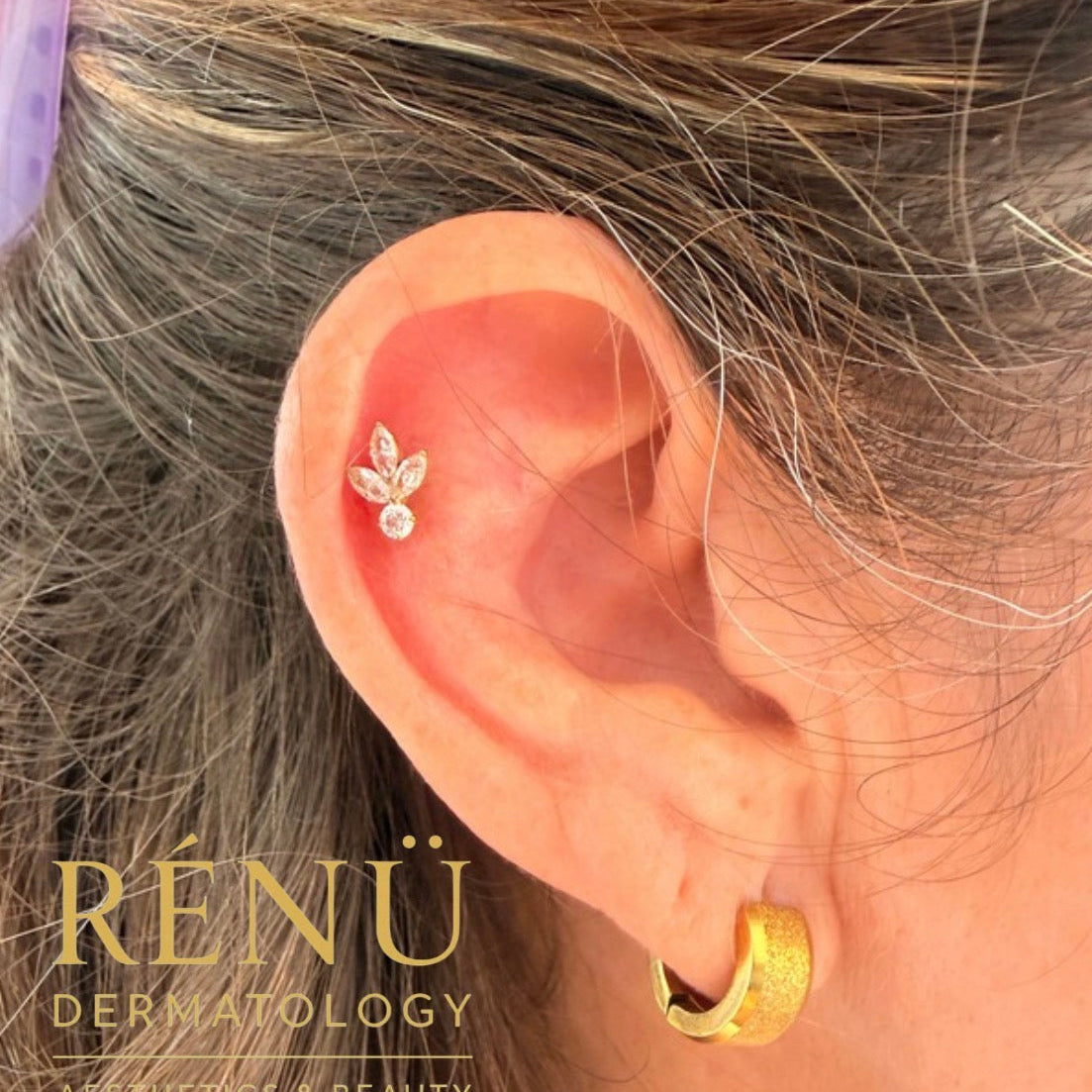 Why High-Quality Jewellery Matters for Your Piercing