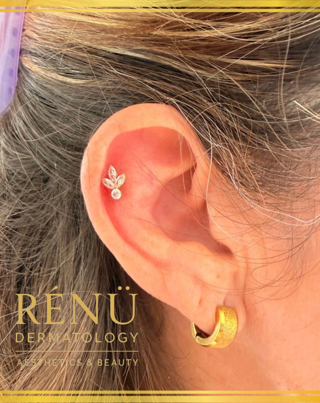 Why High-Quality Jewellery Matters for Your Piercing