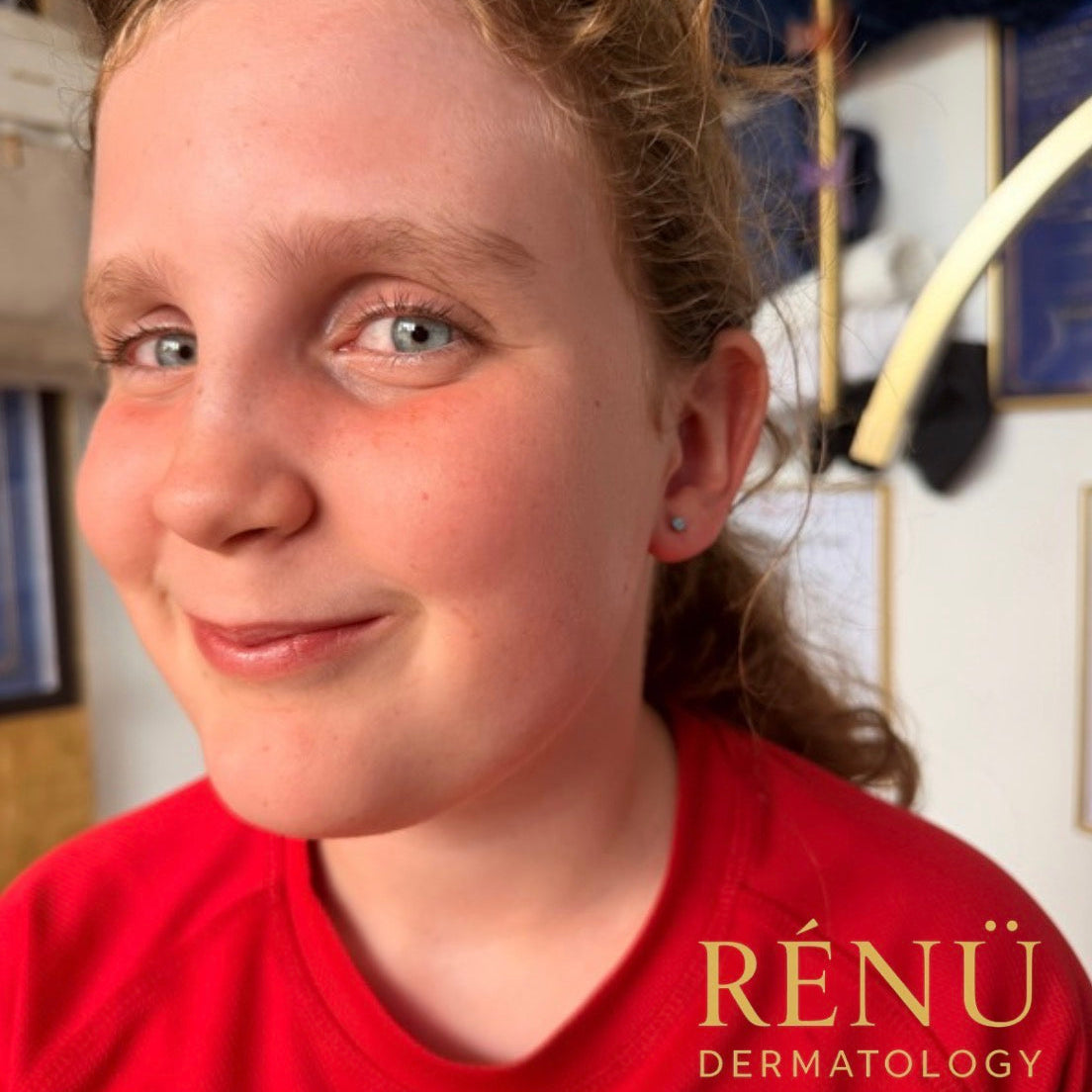 Children's Ear Piercings in the Summer Holidays – A Parent's Guide to Safe Ear Piercing in Lymington & the New Forest