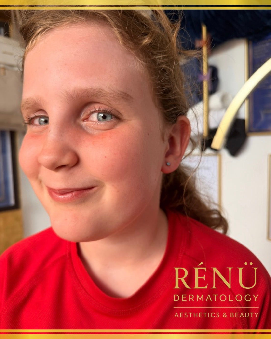 Children's Ear Piercings in the Summer Holidays – A Parent's Guide to Safe Ear Piercing in Lymington & the New Forest