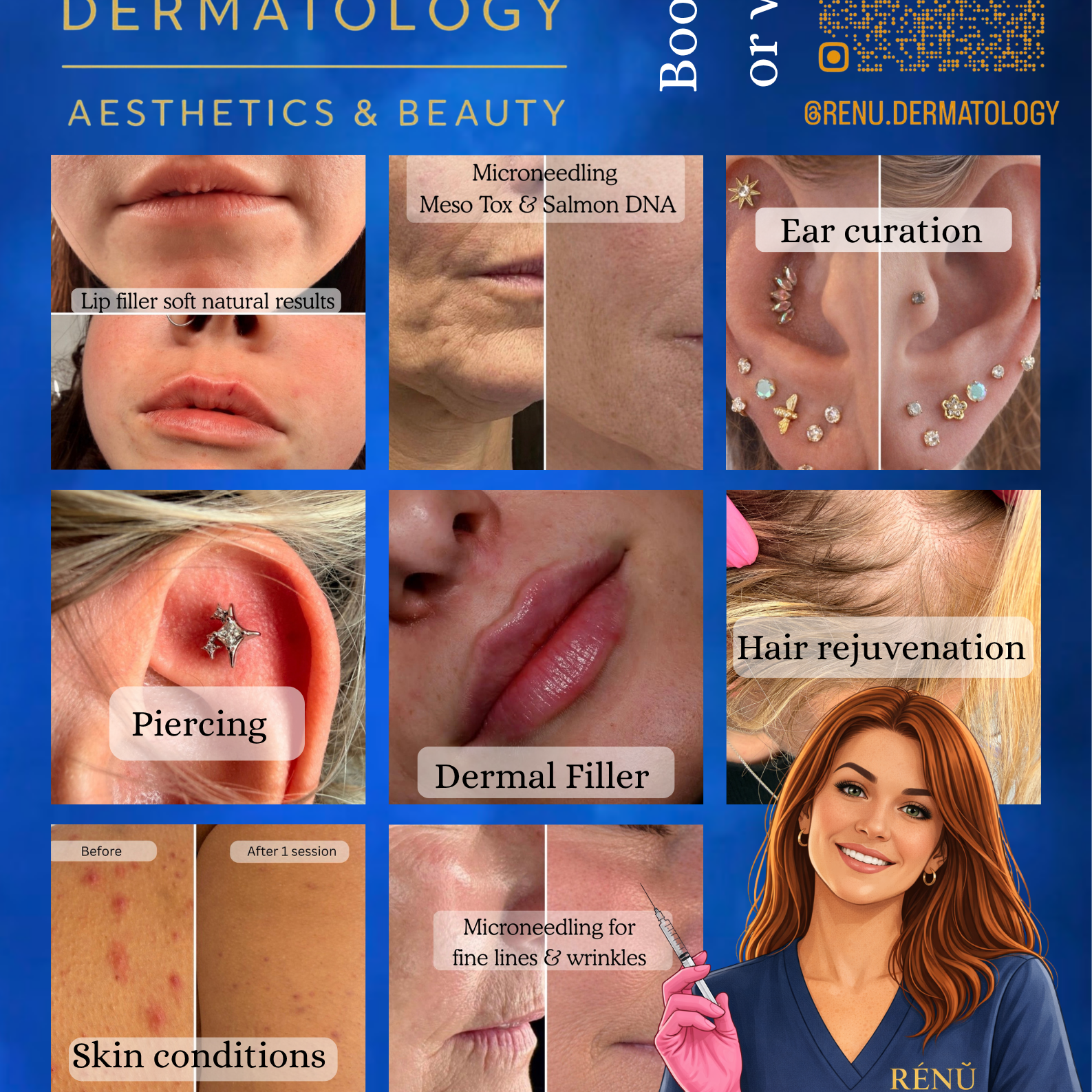 The Ultimate Guide to Aesthetic Treatments in Lymington: How to Achieve Clear, Youthful, Glowing Skin