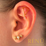 Professional Needle Piercing for Teenagers