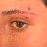 Professional Needle Piercing for Teenagers