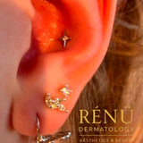 Conch Piercing