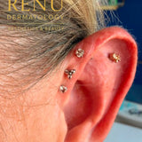 Forward Helix Piercing
