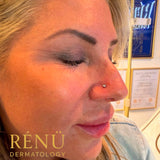Nose Piercing