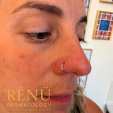 Nose Piercing