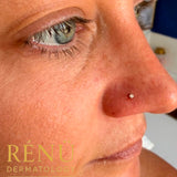 Nose Piercing
