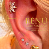 Helix Piercing
