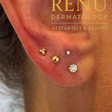 Stacked Lobe