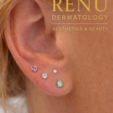 Stacked Lobe