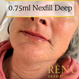 Mature Lip Filler in Lymington – Natural Lip  Rejuvenation