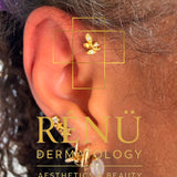Forward Helix Piercing