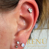 Stacked Lobe