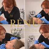 Anti Wrinkle 1 area