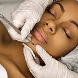 Deep Pore Extraction Facial + Calming Jelly Mask – 70-Minute Steam & Deep Cleanse Treatment